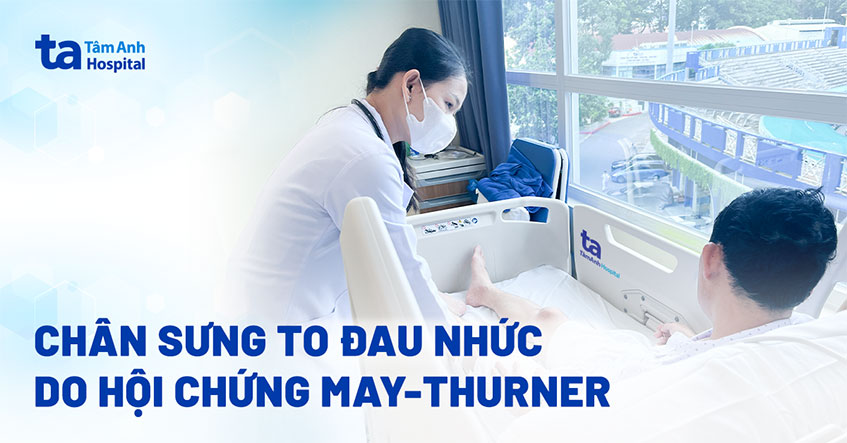 Sưng chân do huyết khối chi chít trong tĩnh mạch đùi