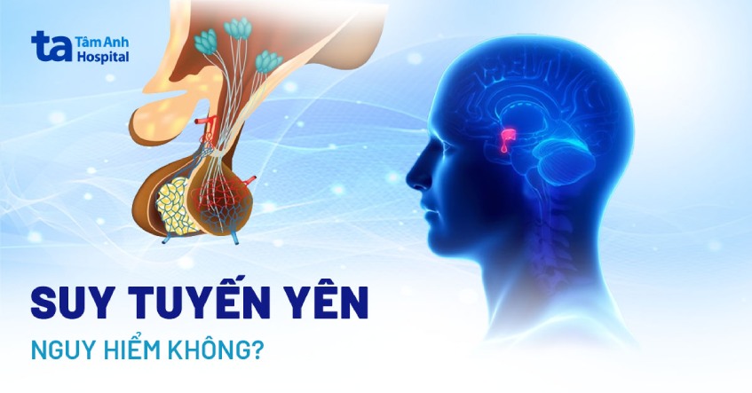 Suy tuyến yên có nguy hiểm không? Cách chăm sóc bệnh nhân hiệu quả