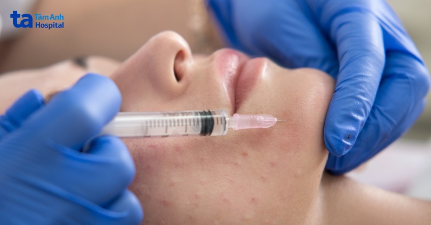 tác dụng phụ có thể gặp sau tiêm meso