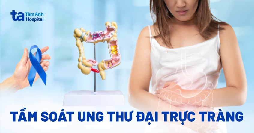Tầm soát ung thư đại trực tràng: Các phương pháp & quy trình chẩn đoán