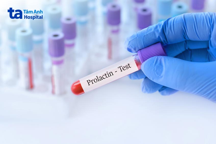 tăng prolactin máu là tình trạng dư thừa prolactin trong máu