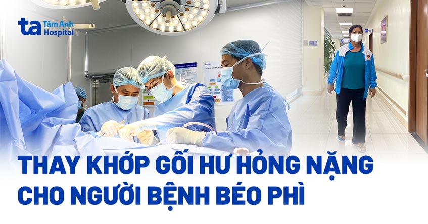 thay khớp gối hư hỏng nặng cho người bệnh béo phì