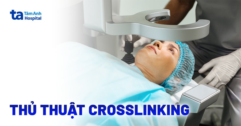 Thủ thuật khúc xạ Crosslinking là gì? Chỉ định và quy trình