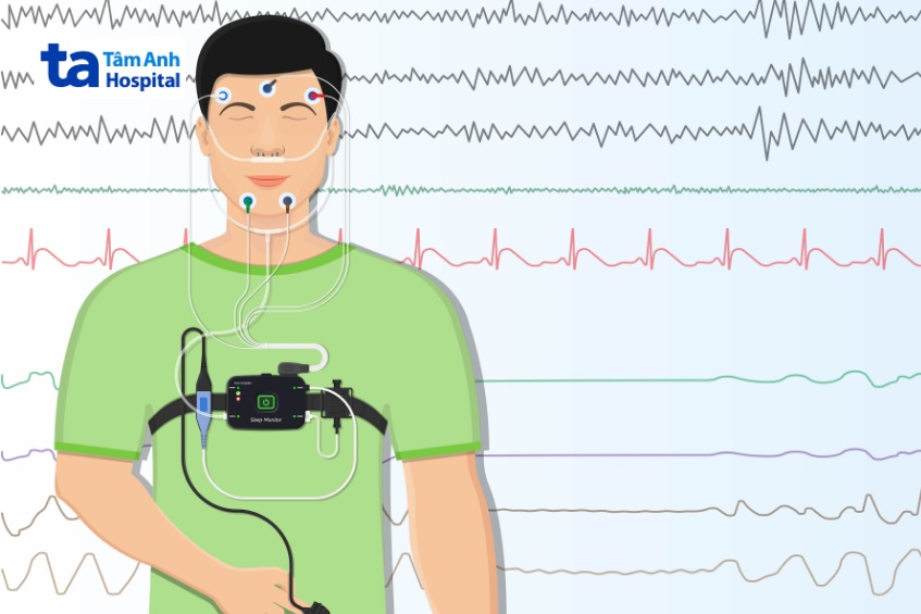 thực hiện đo đa ký giấc ngủ