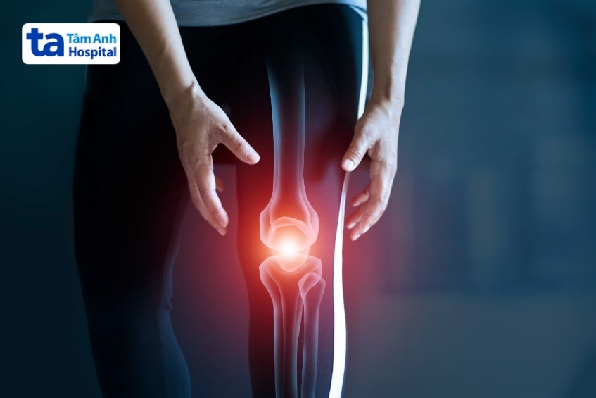 Piascledine 300mg là thuốc gì?