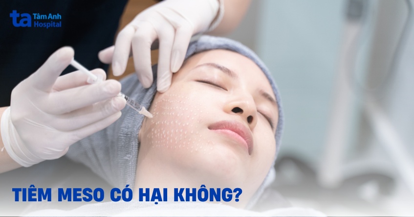 5 tác hại của tiêm meso có nguy hiểm không? Cần lưu ý điều gì?