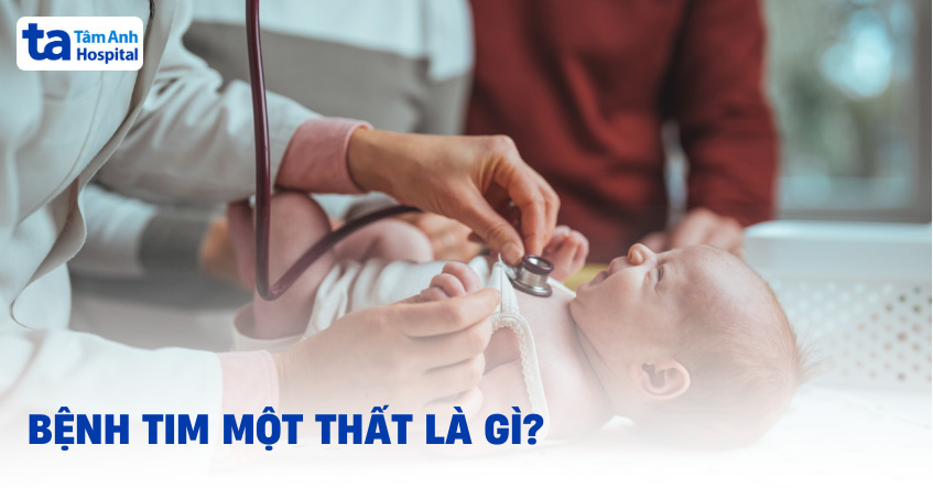 Tim một thất: Nguyên nhân, triệu chứng, chẩn đoán và điều trị