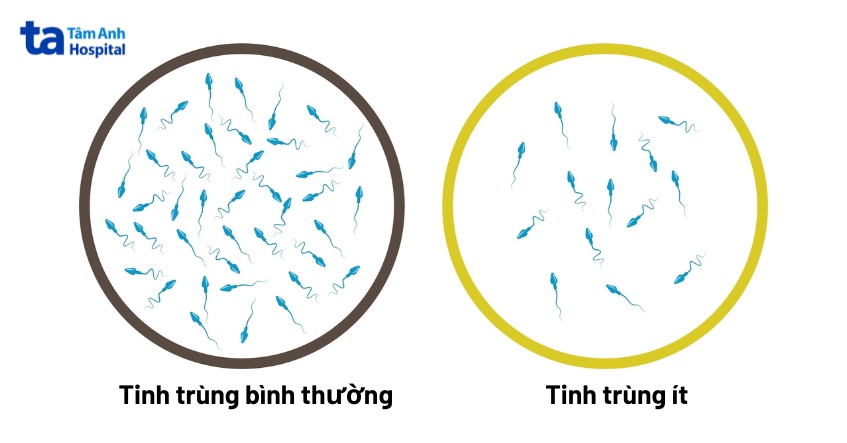 tinh trùng ít là gì