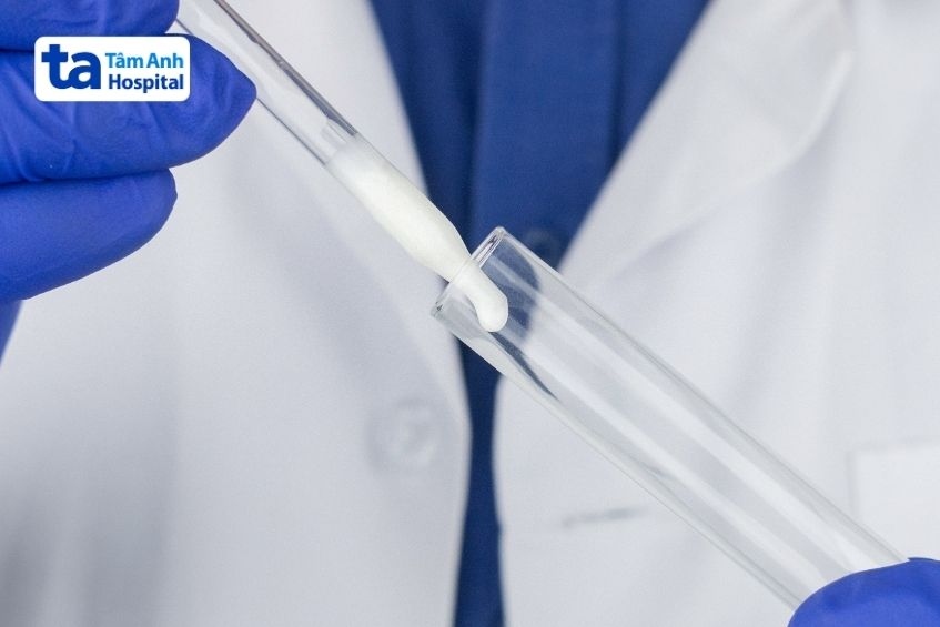 tinh trùng vón cục có chữa được không