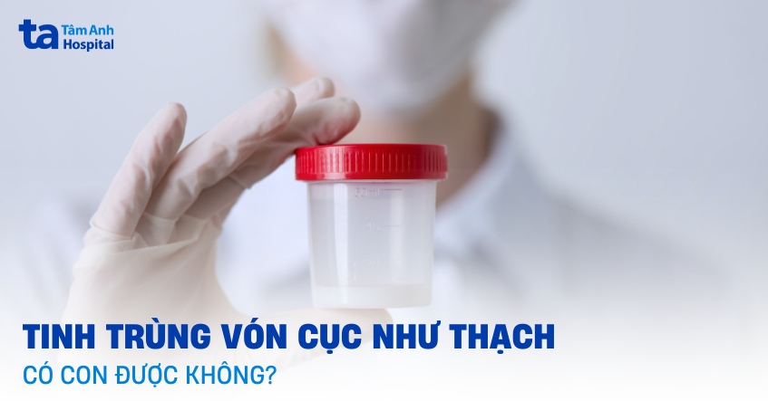Tinh trùng vón cục như thạch có con được không? [Bác sĩ giải đáp]