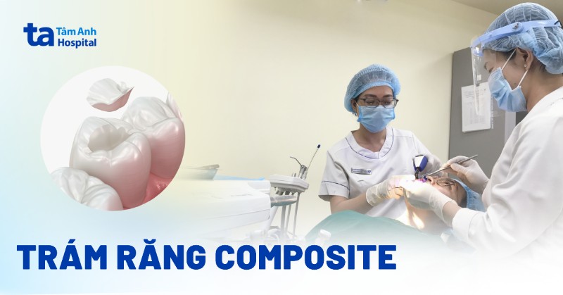 Trám răng composite là gì? Có bền không? Chi phí có đắt không?