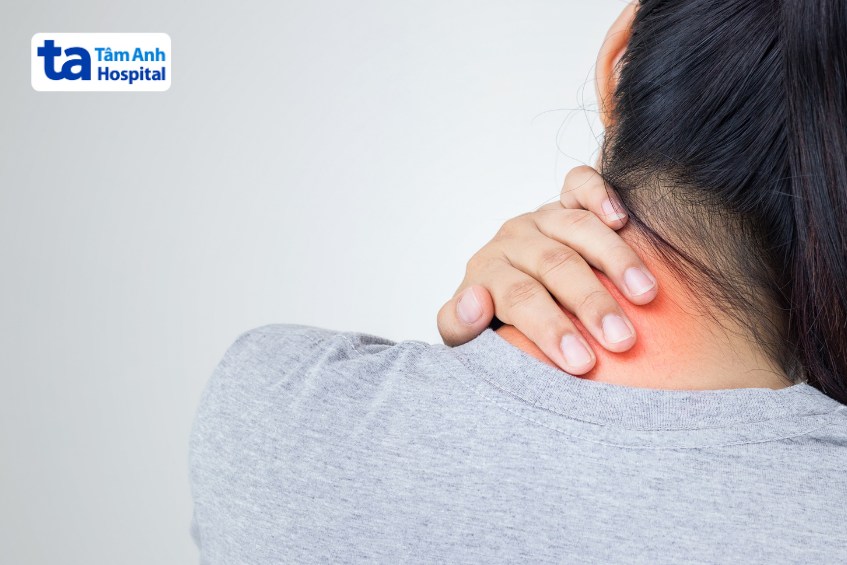 triệu chứng đau dây thần kinh chẩm cần điều trị