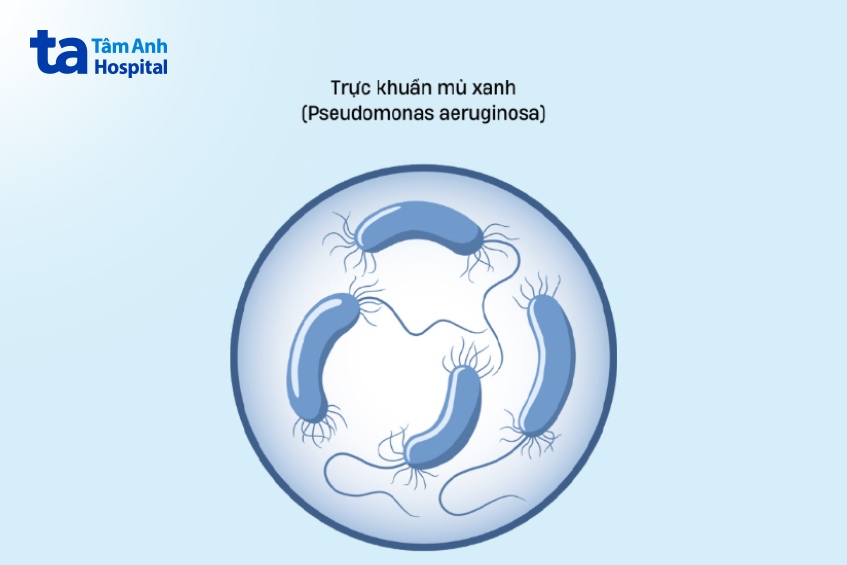 trực khuẩn mủ xanh gây viêm ống tai