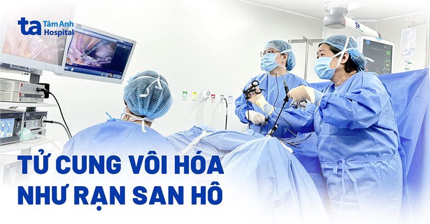 Tử cung vôi hóa sau 26 năm mãn kinh