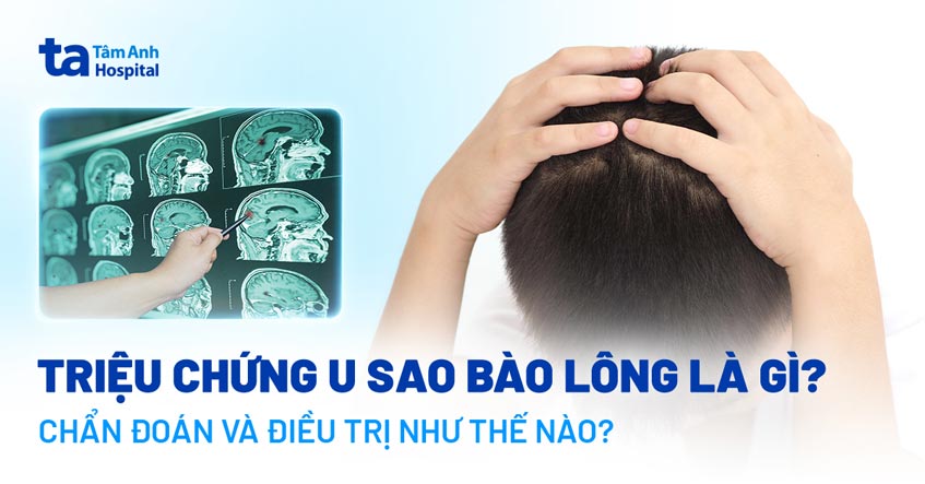 u sao bào lông