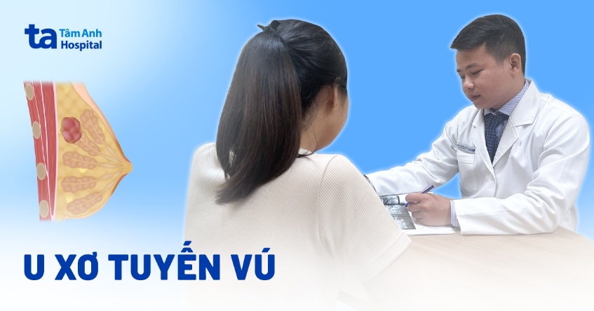 u xơ tuyến vú