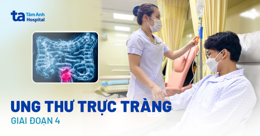 Ung thư trực tràng giai đoạn 4: Triệu chứng, tiên lượng và điều trị