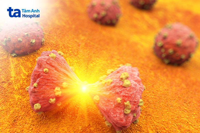 ung thư vú thể chuyển sản