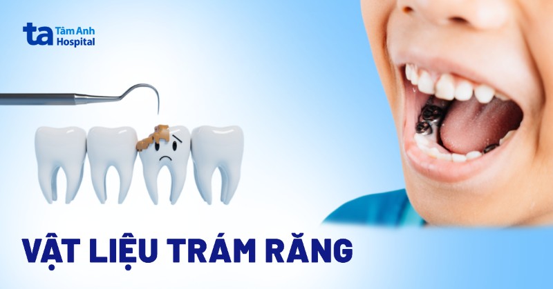 vật liệu trám răng