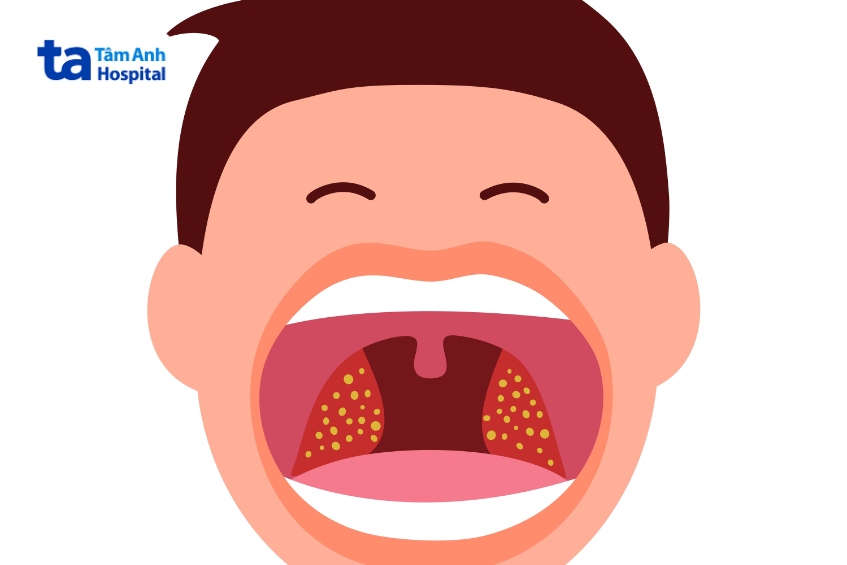 vi khuẩn bệnh bạch hầu