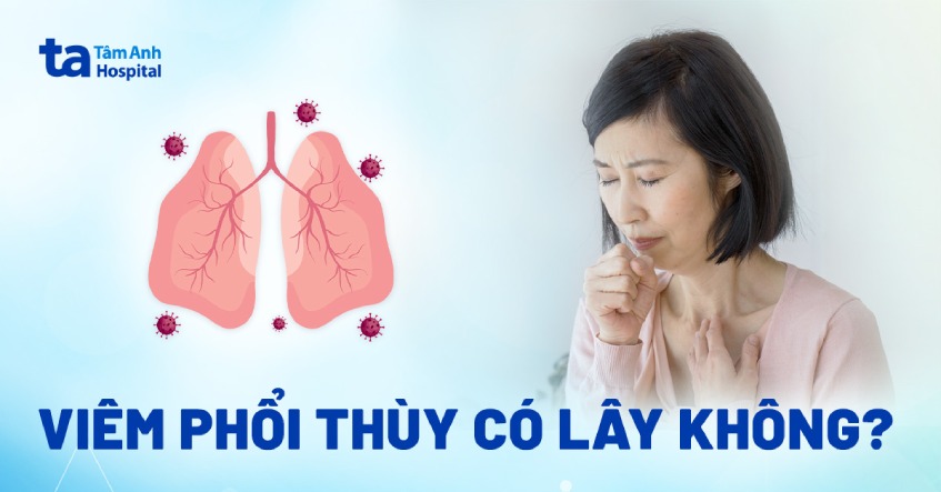 Viêm phổi thùy có lây không? Lây qua đường nào?