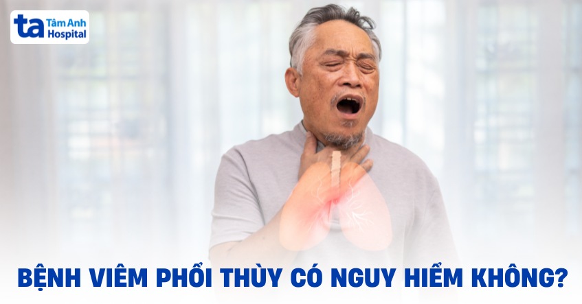 Viêm phổi thùy có nguy hiểm không? Yếu tố nguy cơ mắc bệnh?