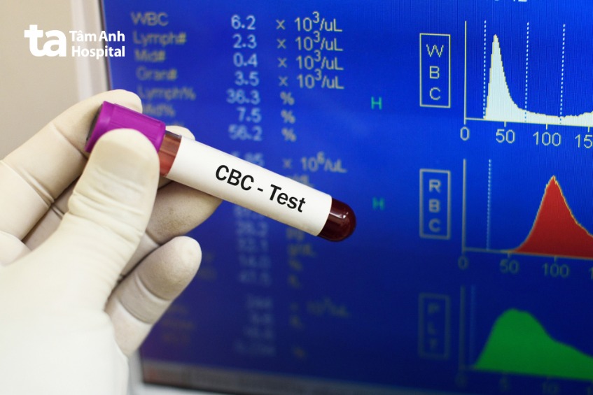 xét nghiệm chẩn đoán ung thư trực tràng giai đoạn 4