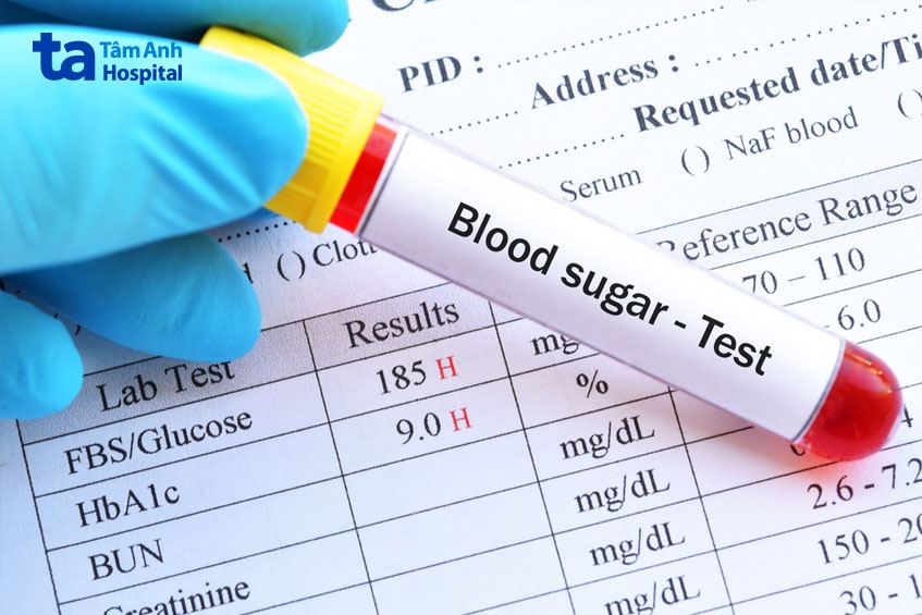 Xét nghiệm đường huyết lúc đói