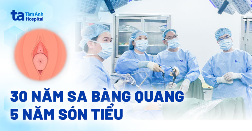 30 năm sa bàng quang, 5 năm són tiểu