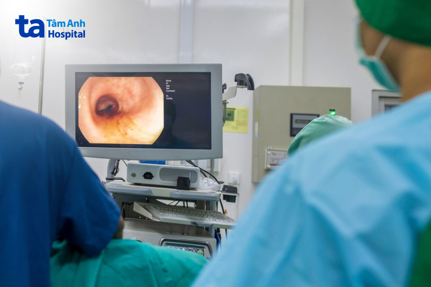 bác sĩ đang thực hiện nội soi cho người bệnh