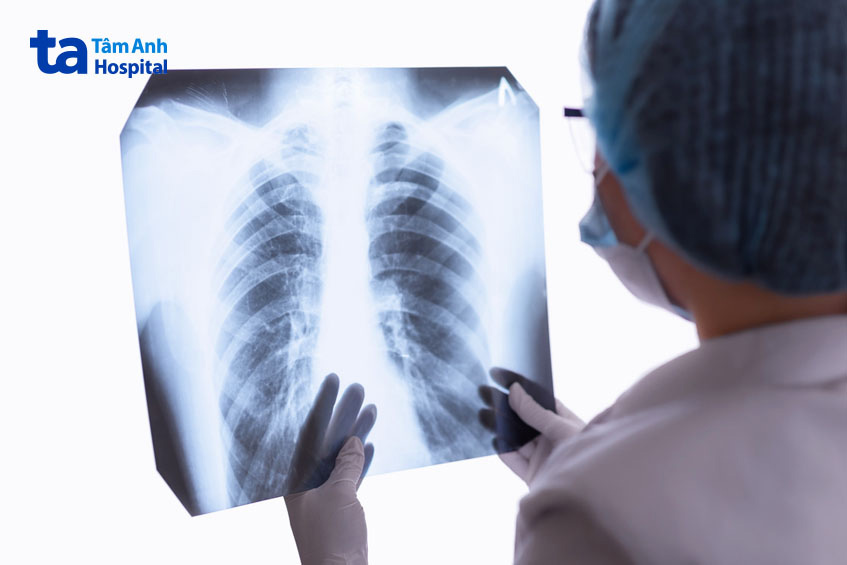 Bác sĩ kiểm tra tổng quan các chỉ số sinh tồn, kết hợp chẩn đoán hình ảnh để đánh giá nguy cơ ở các hệ cơ quan, nhất là tim mạch và hô hấp