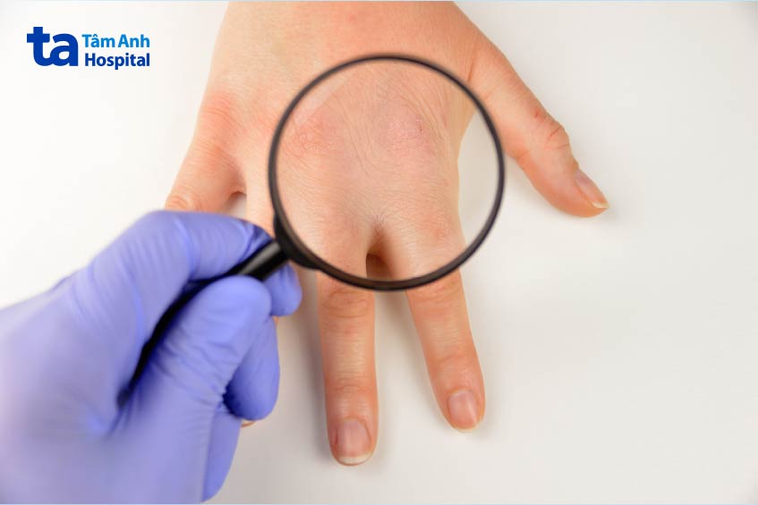 bác sĩ sẽ kiểm tra toàn diện