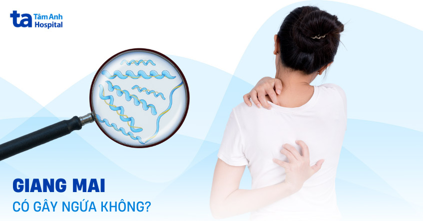 Bệnh giang mai có ngứa không? Nên làm gì khi bị ngứa?