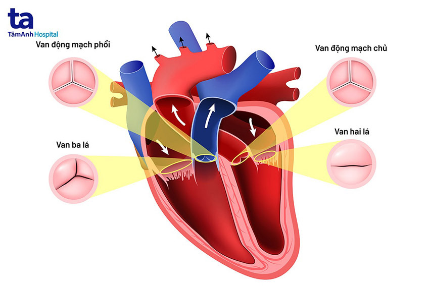 Bệnh hở van tim chia làm 4 loại tương ứng với 4 van tim