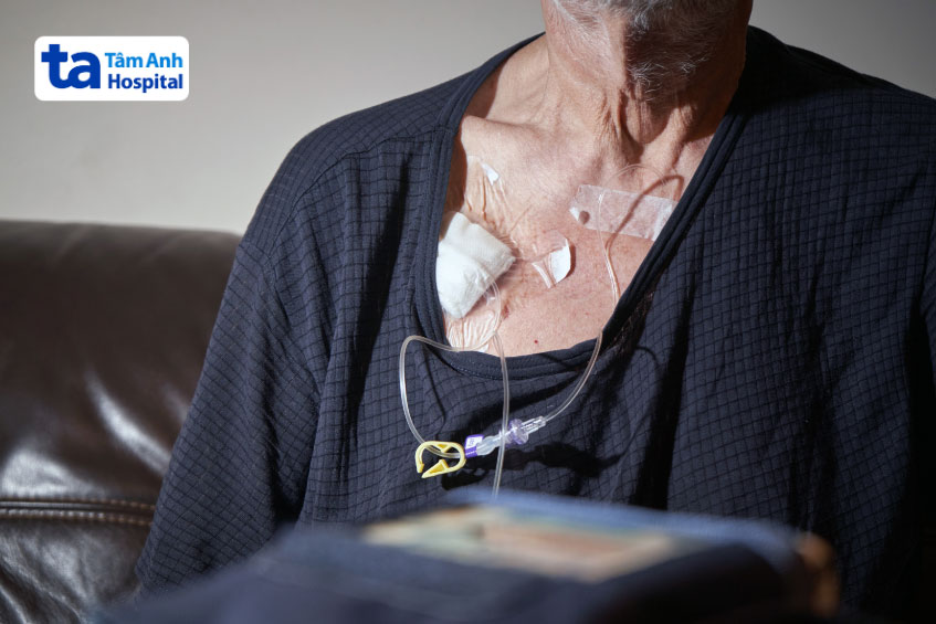 Bệnh nhân đặt catheter không sử dụng bioflora
