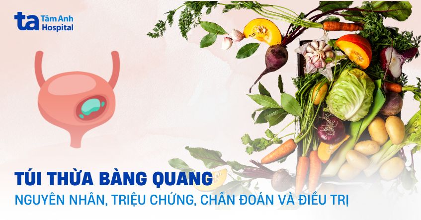 bệnh túi thừa bàng quang
