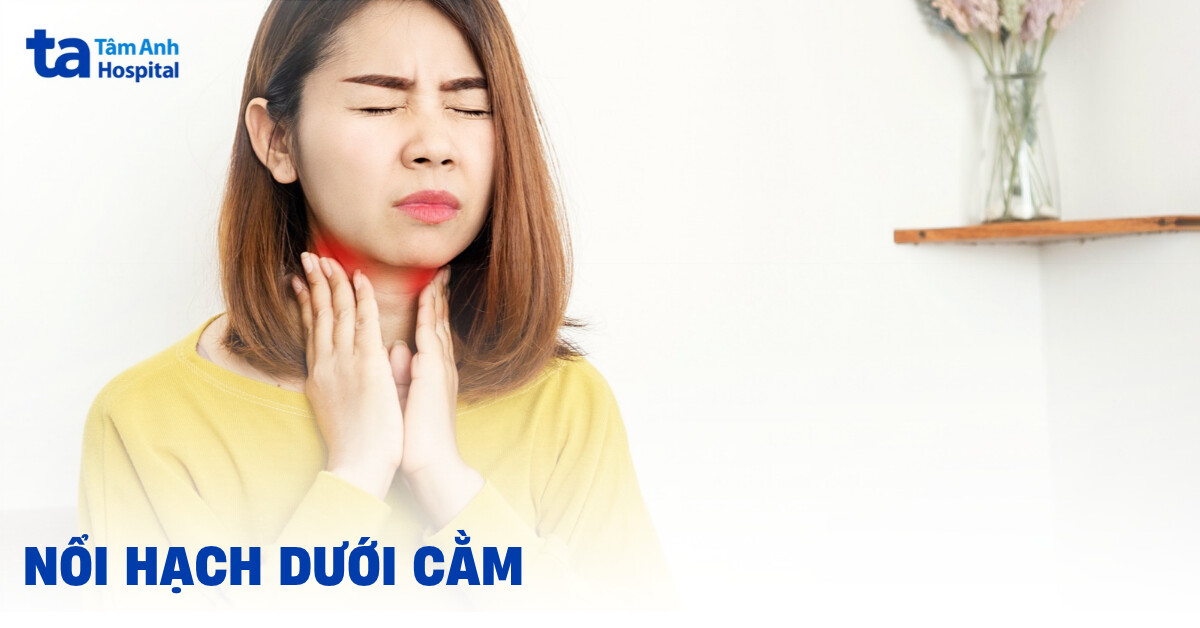 bị nổi hạch dưới cằm