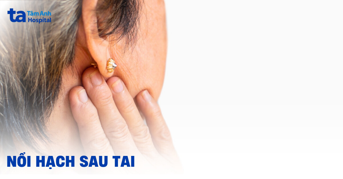 Nổi hạch sau tai: Nguyên nhân, dấu hiệu và cách chẩn đoán