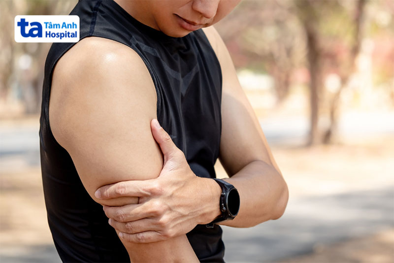 Triệu chứng bị viêm cơ bắp tay