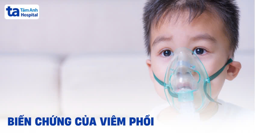 10 biến chứng viêm phổi nguy hiểm người bệnh cần cảnh giác