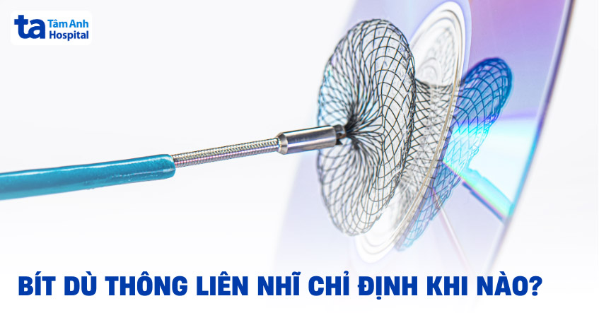 Bít dù thông liên nhĩ