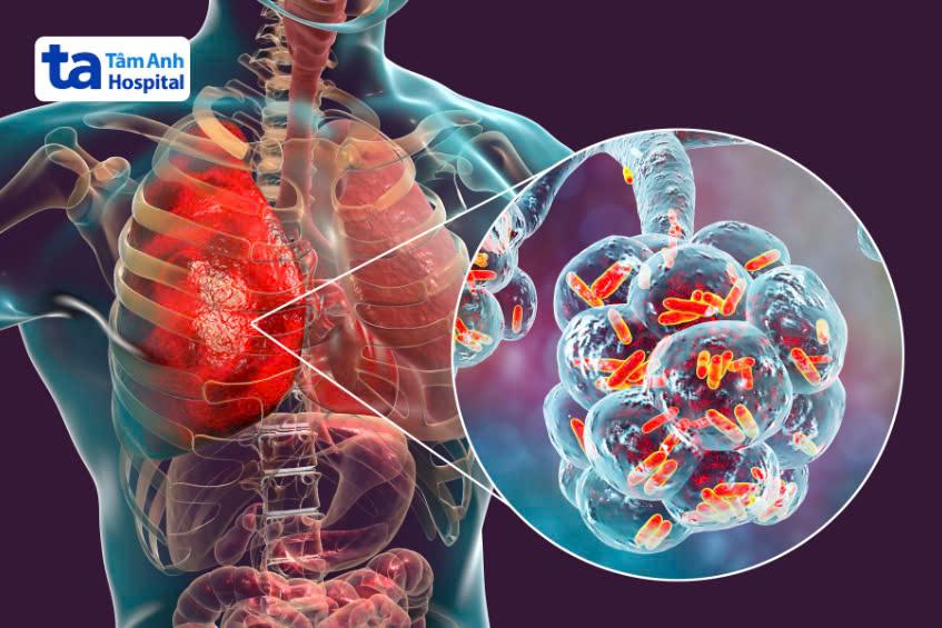 Bỏ các thói quen có hại để bảo vệ phổi khỏe mạnh