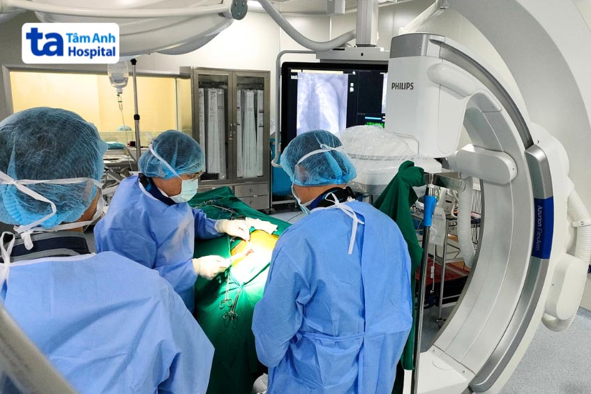 Các bác sĩ tại BVĐK Tâm Anh thực hiện đặt máy khử rung ICD