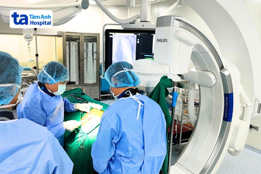 Bác sĩ tại BVĐK Tâm Anh thực hiện phẫu thuật đặt máy khử rung tim ICD