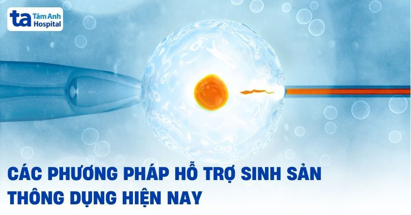14 phương pháp hỗ trợ sinh sản hiện nay thông dụng trong điều trị