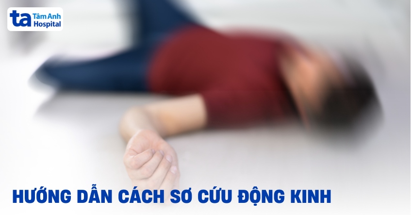 Hướng dẫn cách sơ cứu động kinh xử trí đúng kỹ thuật, an toàn