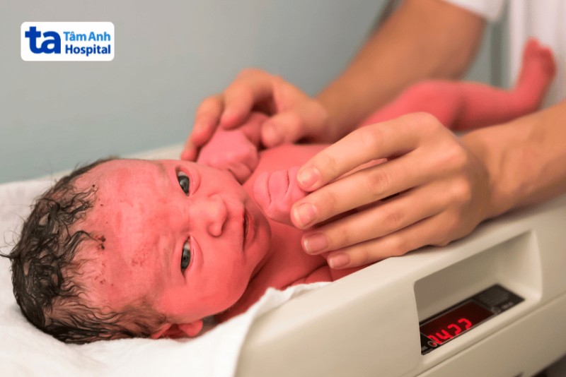 Dấu hiệu nhận biết trẻ sơ sinh cần tăng cân