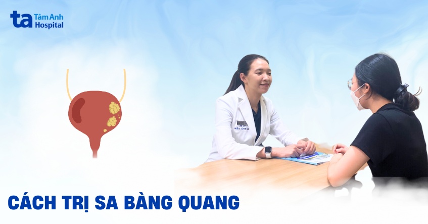 5 cách trị sa bàng quang hiệu quả theo từng giai đoạn