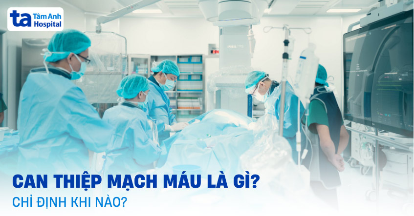 Can thiệp mạch máu: Vai trò, chỉ định và quy trình [A-Z]