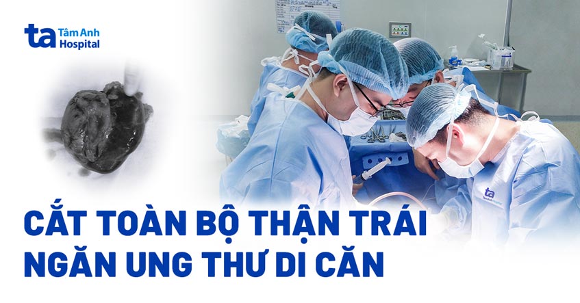 Cắt toàn bộ thận trái ngăn ung thư di căn